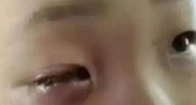 【暑期防范】這東西家家都有，千萬要防范！