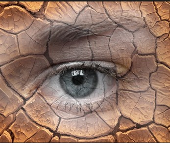 干眼癥，“反季節(jié)”眼病來襲