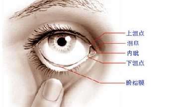 淚道病，眼部的隱形威脅