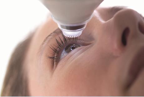 近視手術(shù)固然好，但別盲目做！