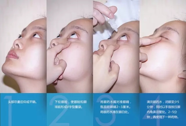 眼藥水你點(diǎn)對(duì)了嗎？快來(lái)看看！