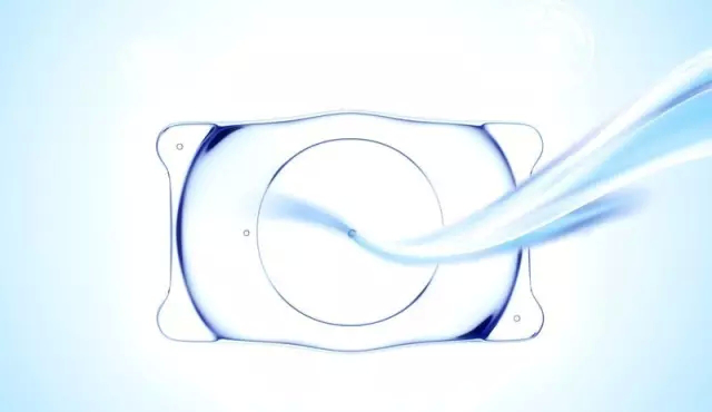 ICL晶體植入術(shù)，可以裝在眼睛里的近視鏡！