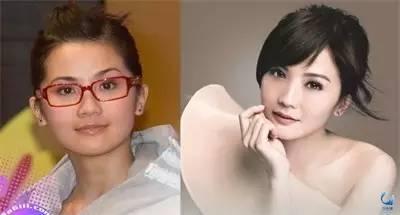 那些近視戴鏡暴丑的女明星們是做了什么變美了？？？