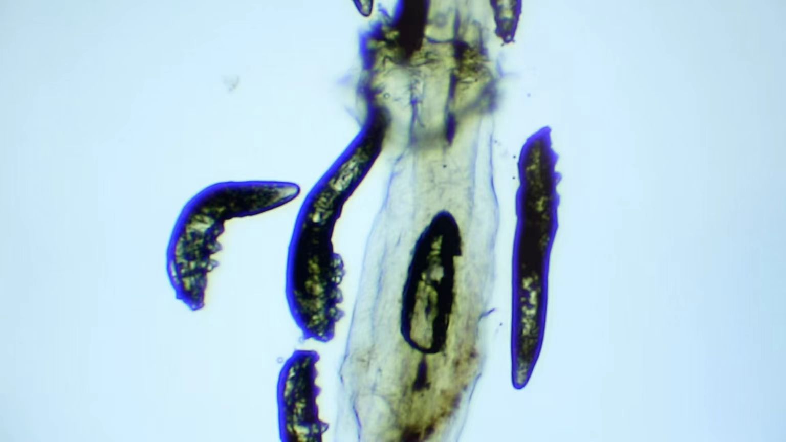 冬季干眼高發(fā)，久治不愈或是睫毛上的螨蟲在作祟！